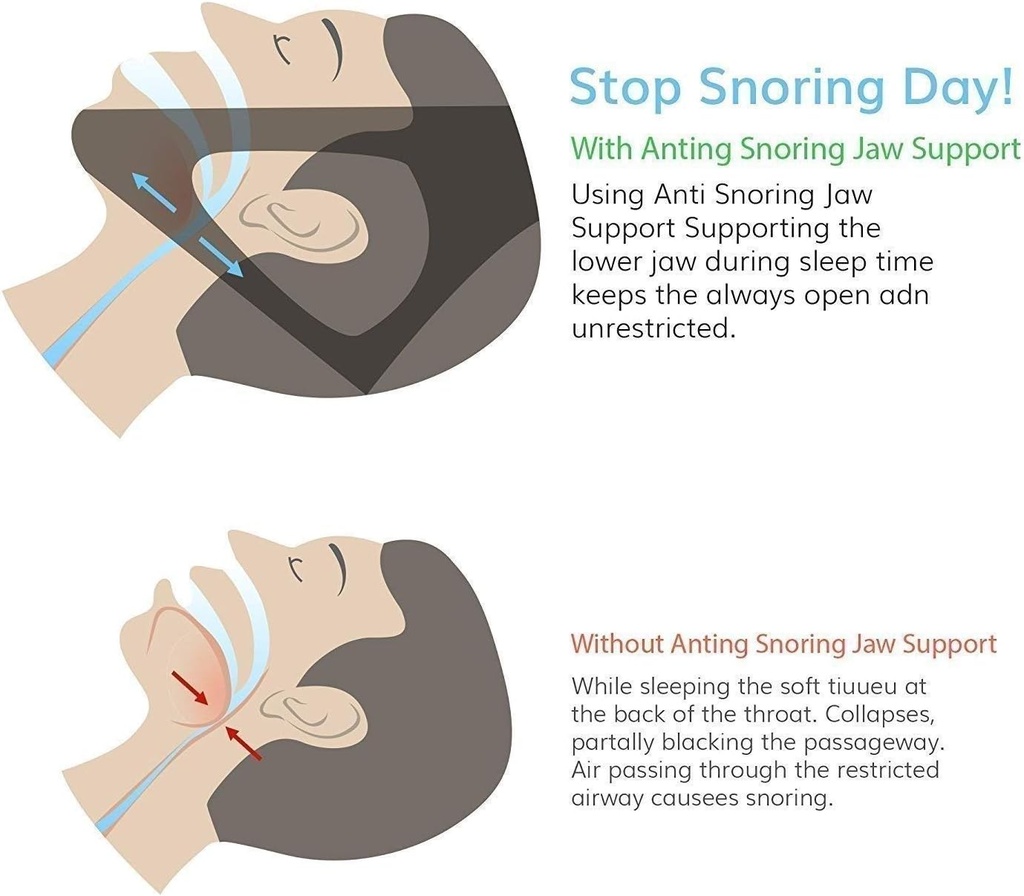 Anti-Snoring Chin Support/دعامة الذقن المضادة للشخير