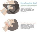 Anti-Snoring Chin Support/دعامة الذقن المضادة للشخير