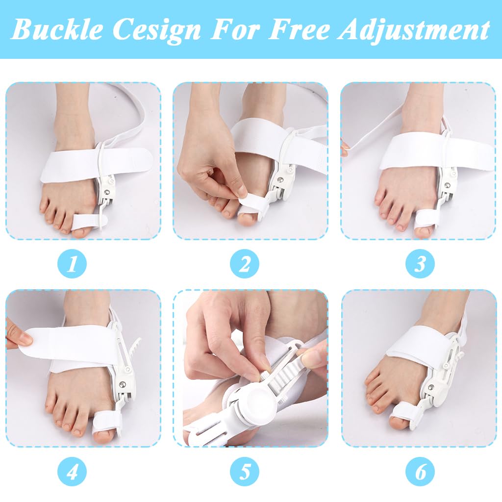 Feet Bunion Corrector/مصحح إبهام القدم