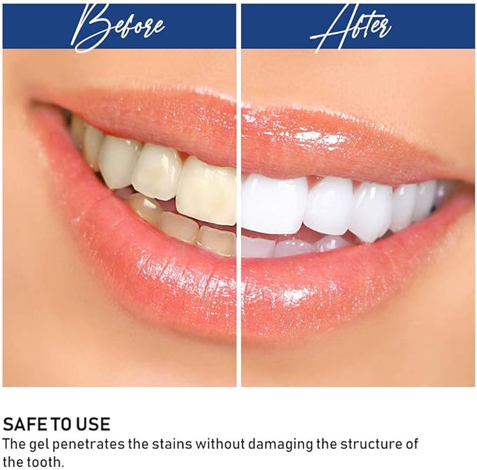 20 MINUTE DENTAL WHITE/جهاز تبيض الأسنان