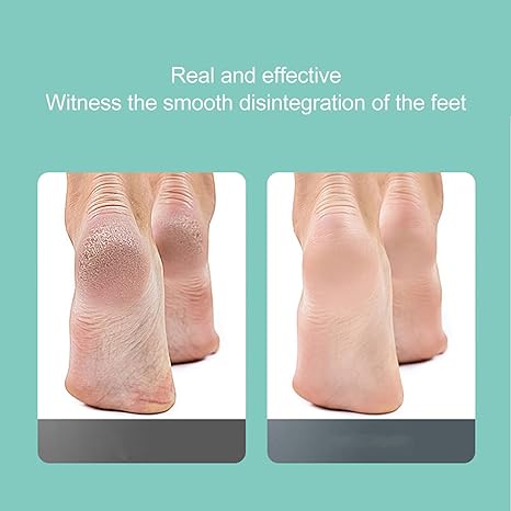 FIND BACK CALLUS REMOVER / جهاز إزالة تشققات القدم