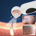 Facial Pore Cleaner Electric/منظف ​​مسام الوجه كهربائي