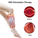 Leg Support / دعامة القدم