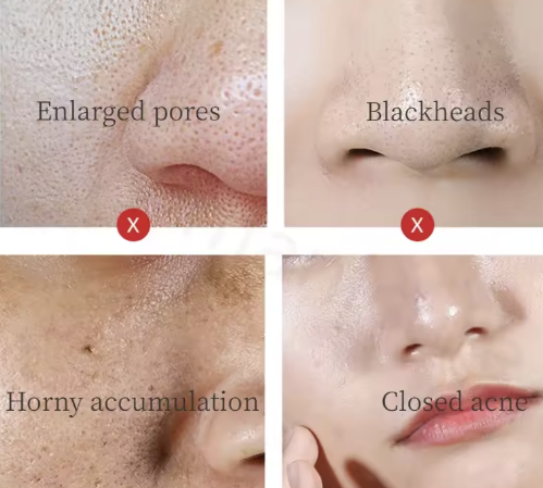 Aerators / أداة عمل الرغوة